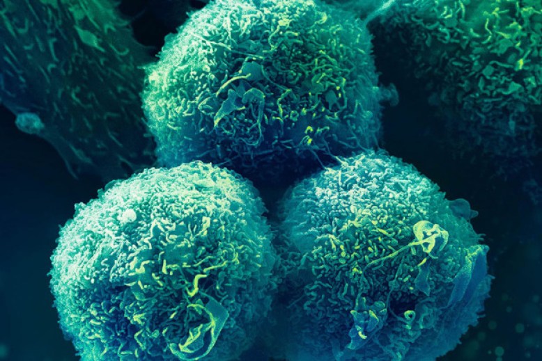 Razvijamo nove pristupe za prevenciju i lečenje raka